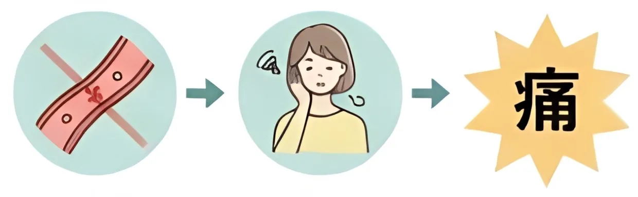 姿勢の崩れが慢性痛になる理由の説明図